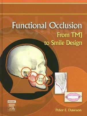 afunctional occlusion