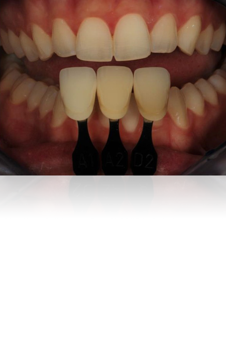 dentalize