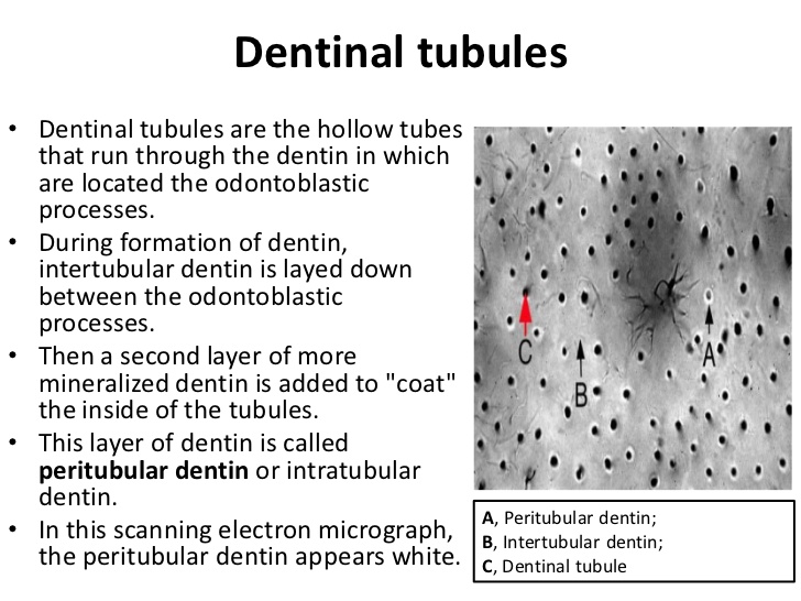 dentinal tubule