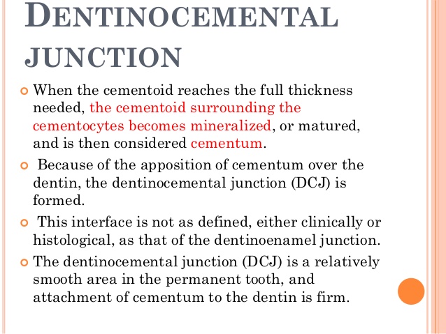 dentinocemental junction