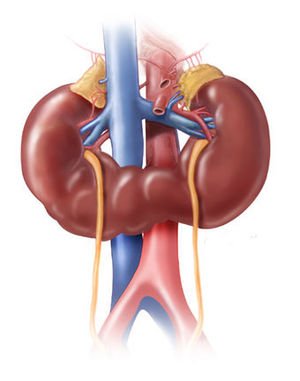 fused kidney