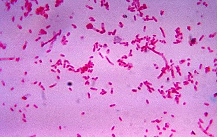 fusobacteria