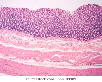 histological