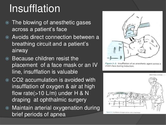 insufflation anesthesia