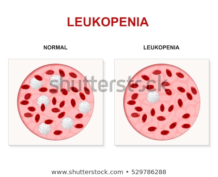 leukocytopenia