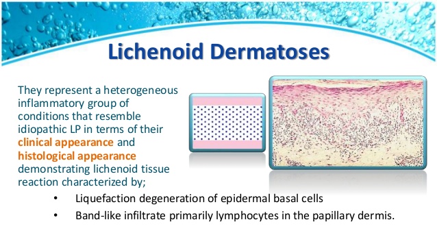 lichenoid dermatosis