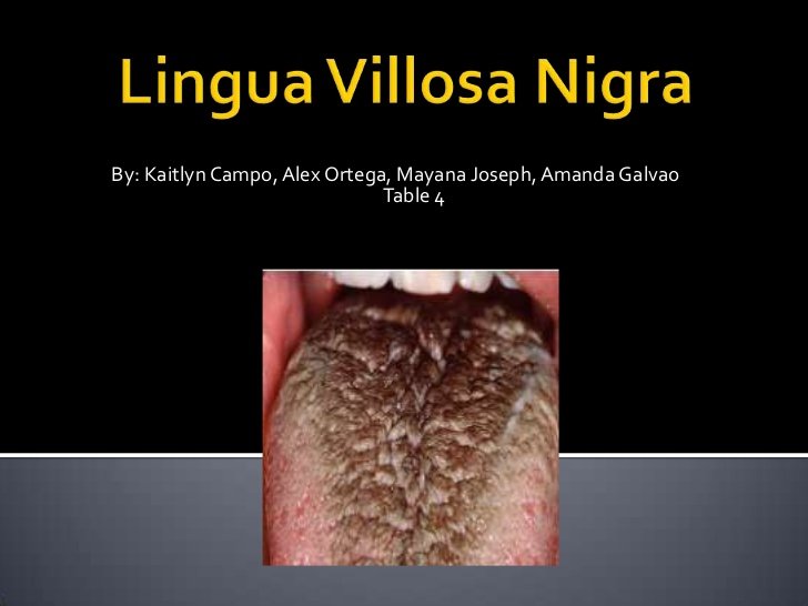 lingua nigra