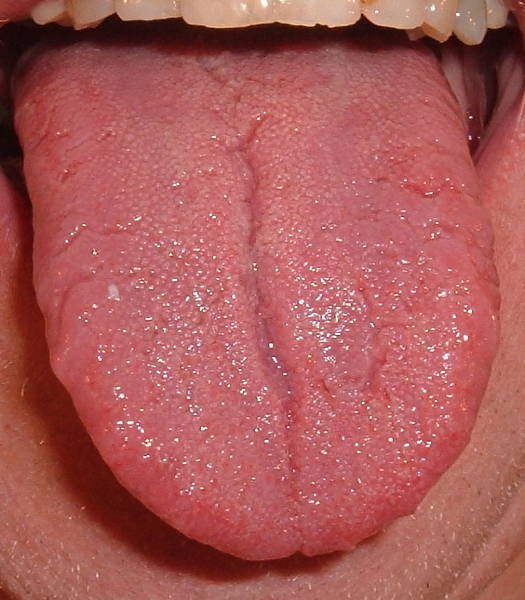 lingua plicata