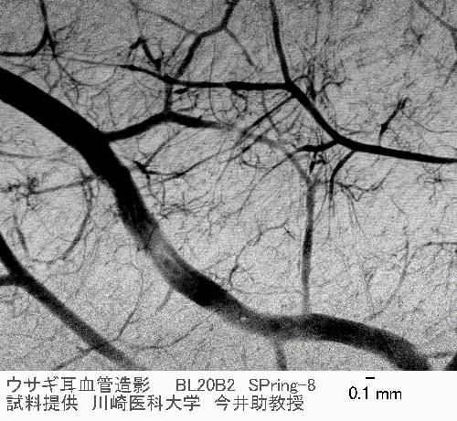 microangiography