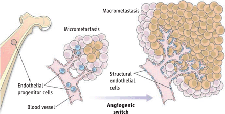 micrometastasis
