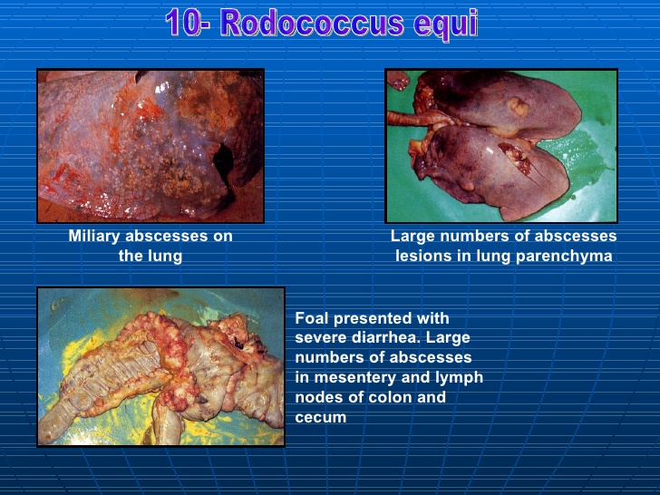 miliary abscess