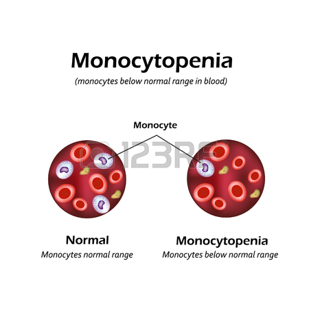 monocytopenia