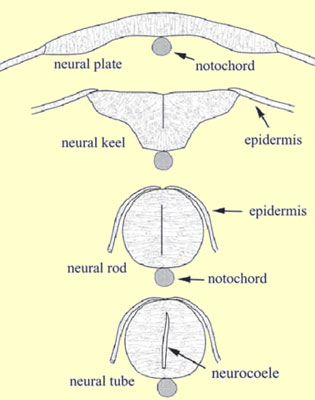 neurocoele