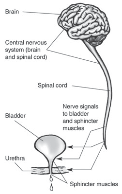 neuropathic bladder