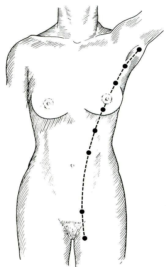 nipple line