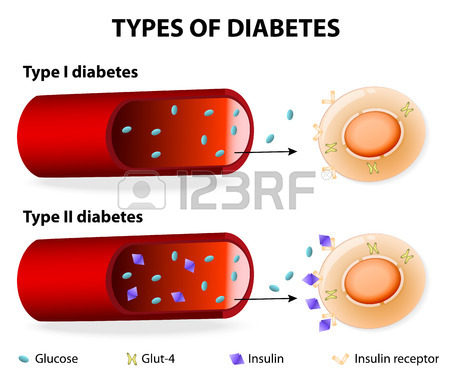 non-insulin-dependent diabetes