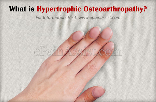 osteoarthropathy