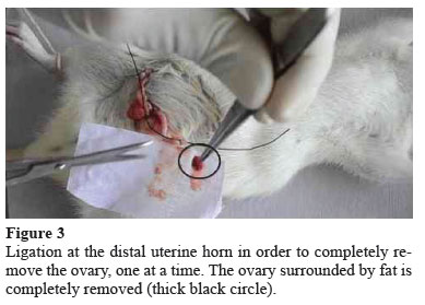 ovariectomy