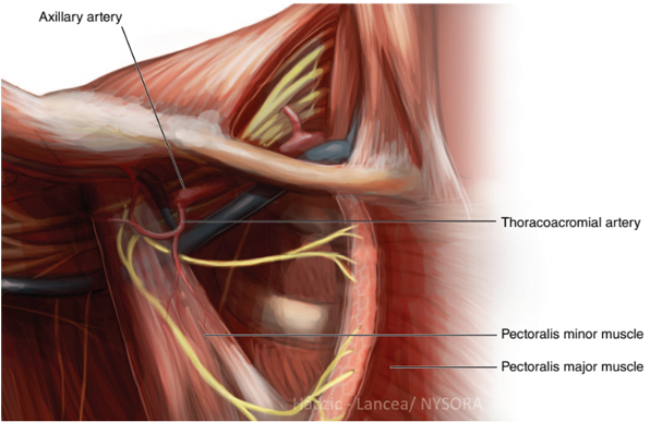 pectoral nerve