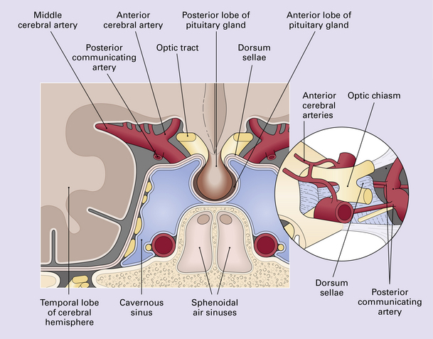 pituitary fossa