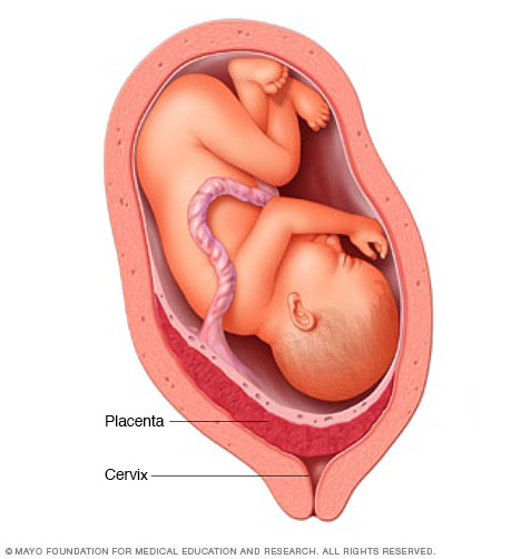 placental