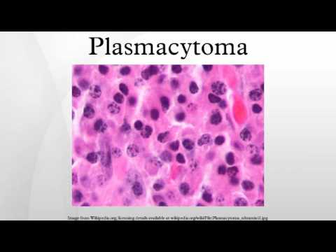plasmacytoma