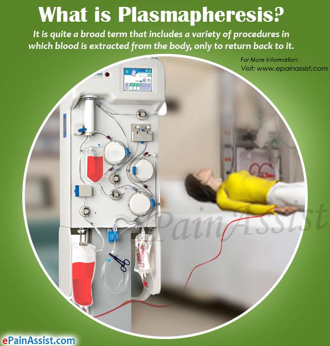 plasmapheretic
