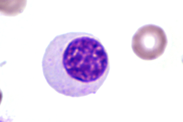 plasmocyte