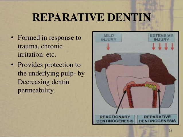 reparative dentin