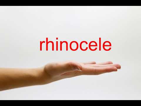 rhinocele