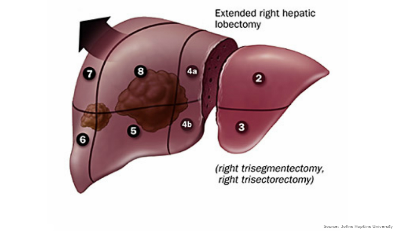 right lobe of liver