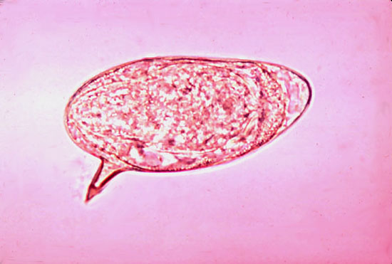 schistosomiasis japonicum