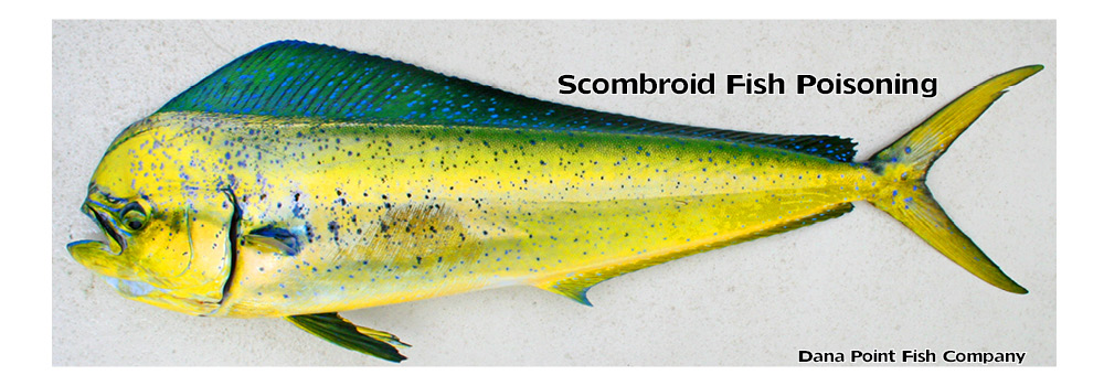 scombroid poisoning
