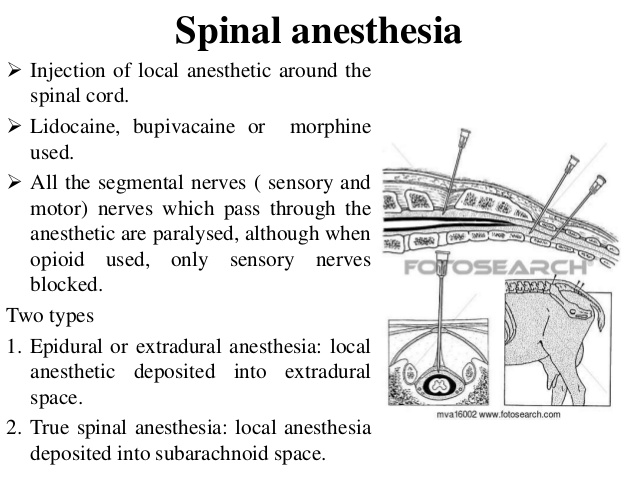 segmental anesthesia