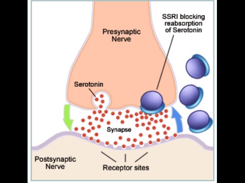 selective serotonin reuptake inhibitor