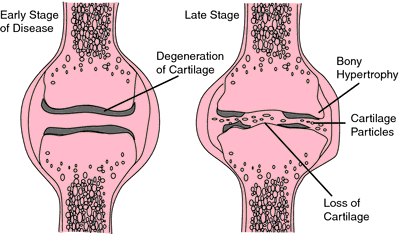 semilunar cartilage