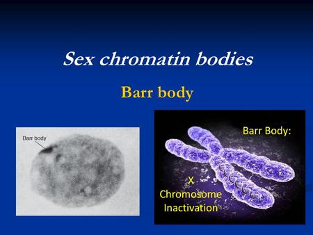 sex chromatin