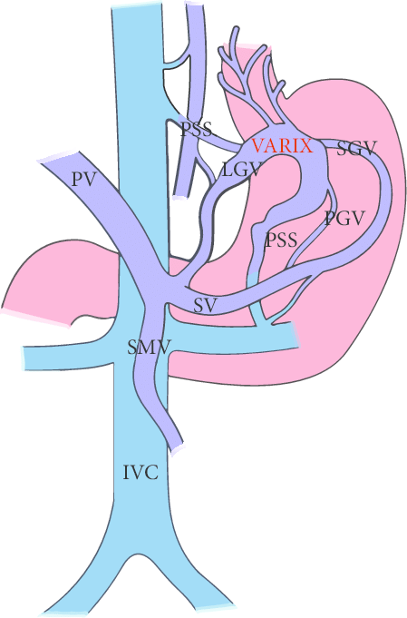 short gastric vein