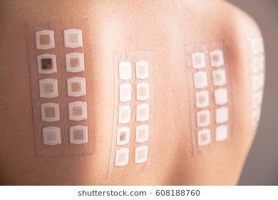skin test