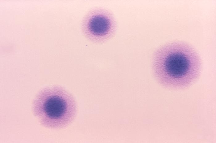 t-mycoplasma
