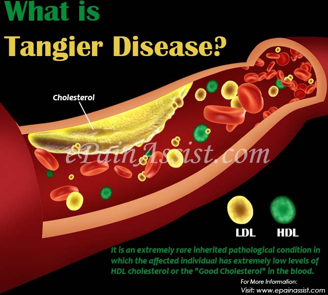 tangier disease
