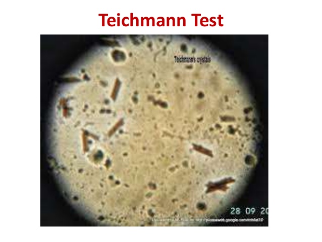teichmann's crystals