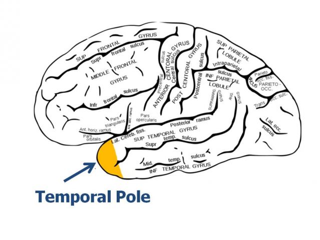 temporal pole