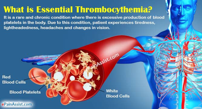 thrombocythemia