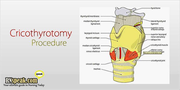 thyrocricotomy