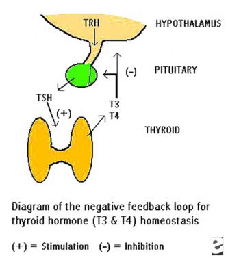 thyrotoxicosis