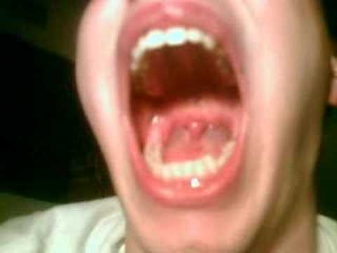 tongue-swallowing
