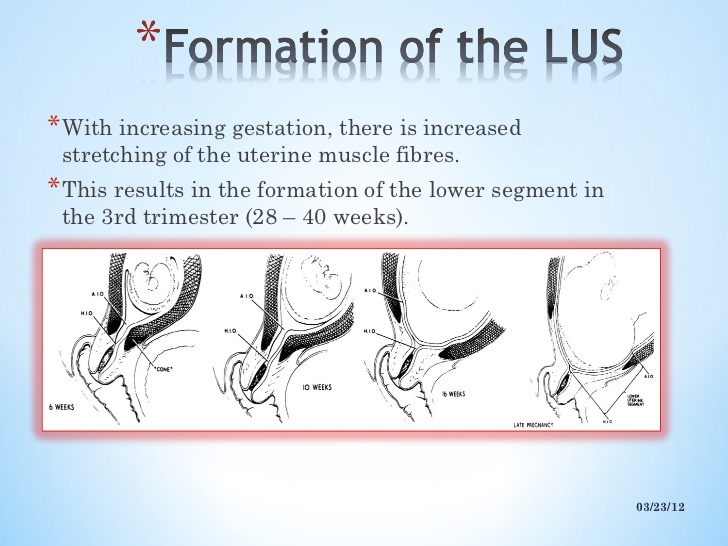 upper uterine segment