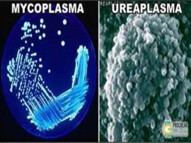 ureaplasma
