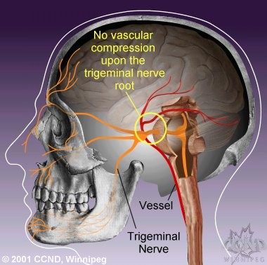 vascular nerve
